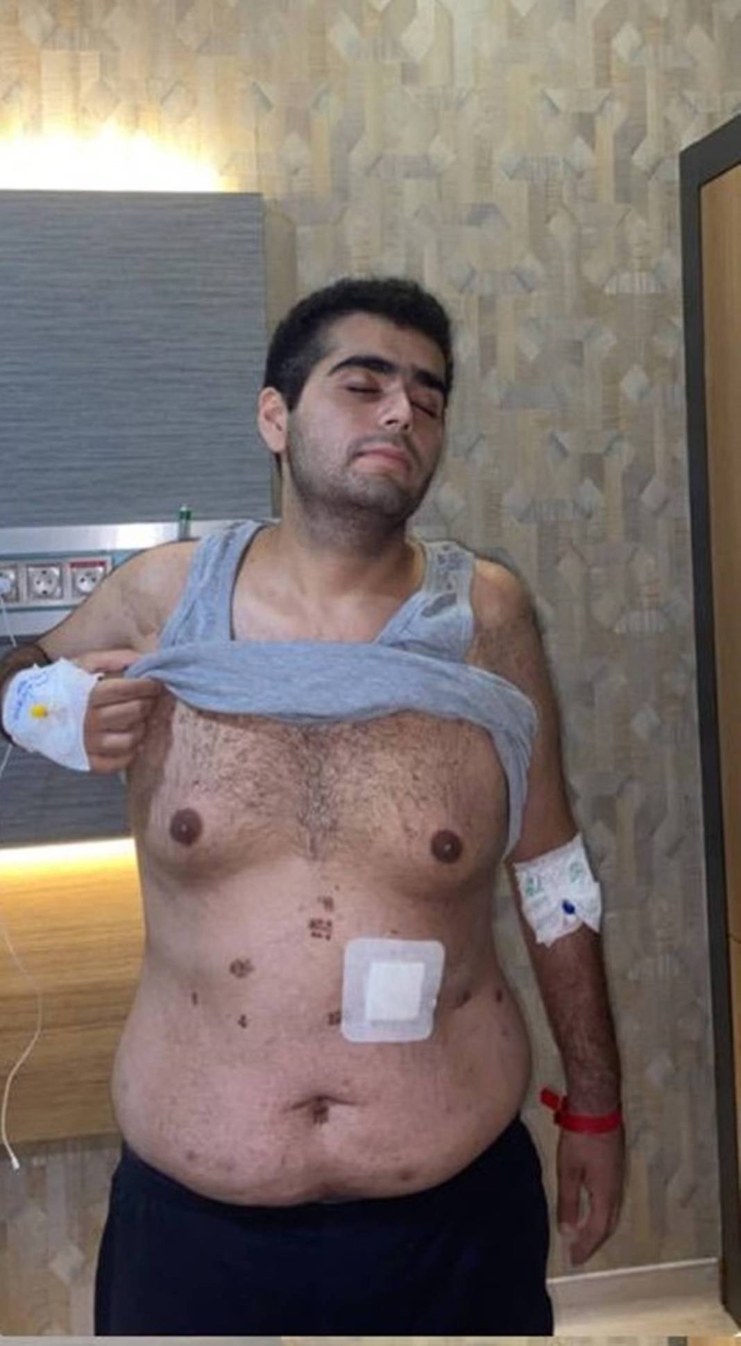 Mide küçültme ameliyatında iki organı kayboldu! Özel hastanede büyük skandal 3